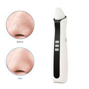 Visual Blackhead Vacuum Suction with Microscope Camera