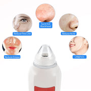 Visual Blackhead Vacuum Suction with Microscope Camera