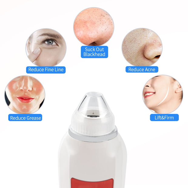 Visual Blackhead Vacuum Suction with Microscope Camera
