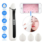 Visual Blackhead Vacuum Suction with Microscope Camera