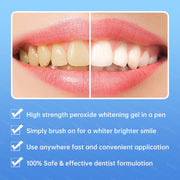 LED Dental Bleaching Teeth Whitening Kit
