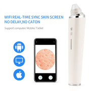 Visual Blackhead Vacuum Suction with Microscope Camera