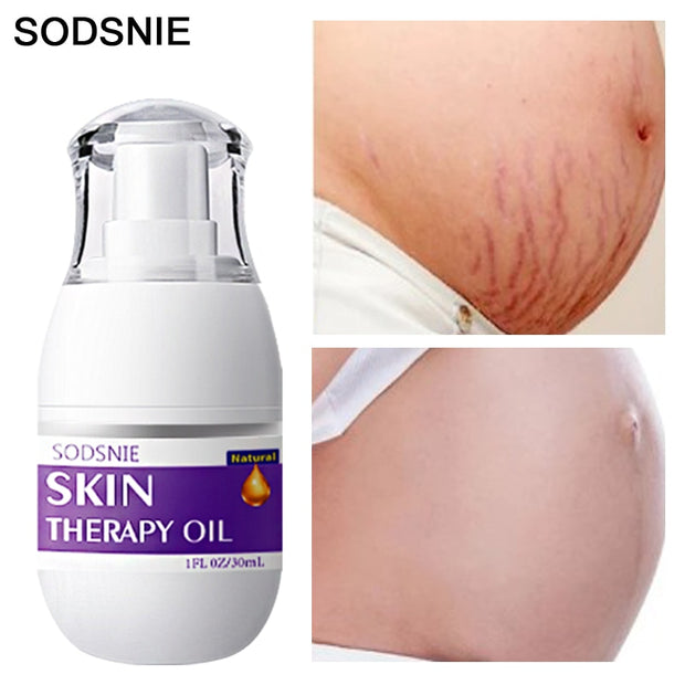 Natural Skin Therapy Oil