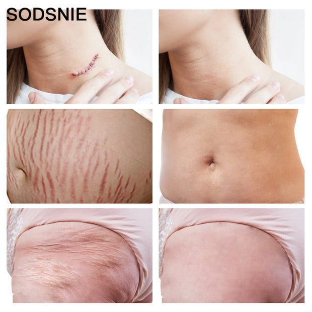 Natural Skin Therapy Oil