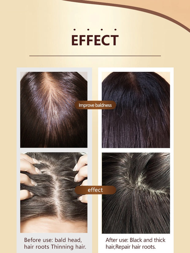 Ginger Hair Growth Serum Essential Oils
