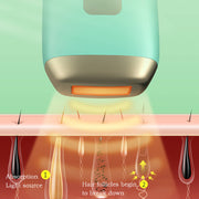 Laser Hair Removal Epilator