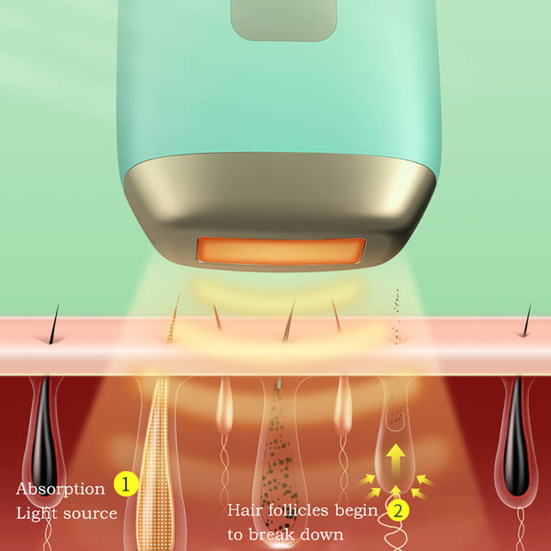 Laser Hair Removal Epilator