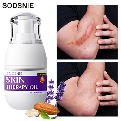 Natural Skin Therapy Oil